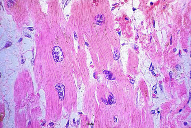 図２０　図１９の心筋細胞のミクロ